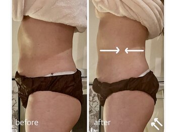 サロン ド サッコ(salon de sacco)/50代女性／下腹・腰まわり