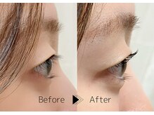 アイビューティー エピ(EyeBeauty epi)/まつ毛カール・ラッシュリフト