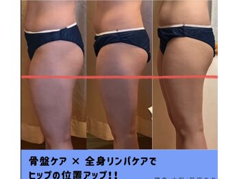 エルバード/夢のヒップアップが実現！