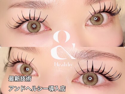 リュイール(LUIRE)の写真