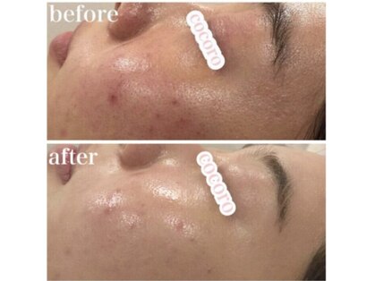 ココロ(COCORO)の写真