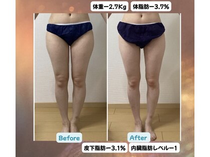 チャルメの写真