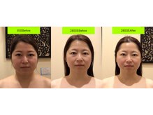 アジール 新潟市(agir)/Before/After 