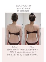 トゥインクル 麻布(twinkle)/南麻布/勝山式美容矯正/小顔矯正