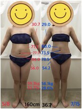 エスティフル 狭山店(ESTIFUL)/[痩身エステ]Before/After