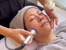 ミュウ 心斎橋店(MYU)/LDM超音波◇水玉リフティング