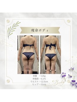 アディッシモ(addissimo)/痩身メニューを豊富にご用意♪