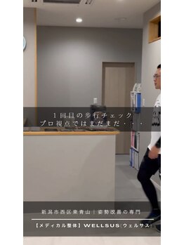 ウェルサス(WELLSUS)/４、インソール効果【反り腰】