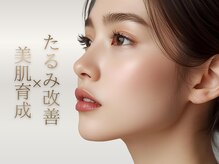 エスポワールカルド(Espoir caldo)