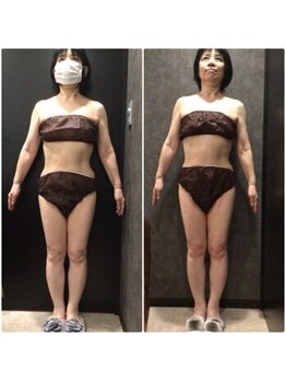 フローボディ 新山口店(flow BODY)/山口のエステはflow BODY