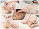 サンク アール(CinQ-R. 美九)の写真/本気の肌改善！！シミ・しわ・年齢肌のお悩み・なかなか治らないニキビケア◎何歳からでも変われます♪♪♪