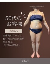 レディラック 大阪梅田本店(Lady Luck)/マイクロウェーブリフトコース