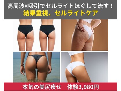 リベア(REBEA)の写真