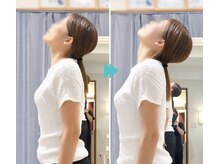 ルポ(REPOS)の雰囲気（首こり・肩こり改善へ│整体で可動域をケアする施術前後の変化）