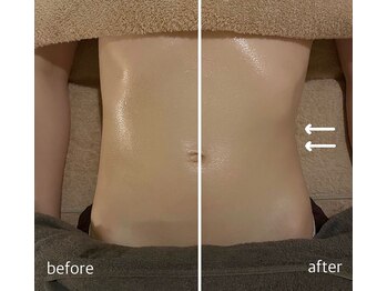 サロン ド サッコ(salon de sacco)/30代女性／くびれのもたつき