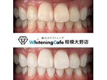 ホワイトニングカフェ 相模大野店(WhiteningCafe)
