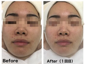 ペリドット(Peridot)/