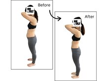 リザルト 上石神井(RESULT)/ビフォーアフター【痩身】