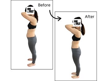 リザルト 上石神井(RESULT)/ビフォーアフター【痩身】