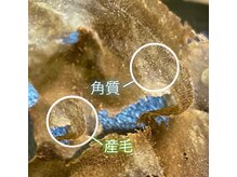 美肌脱毛専門店 パールプラス 大在店/ハーブピーリング