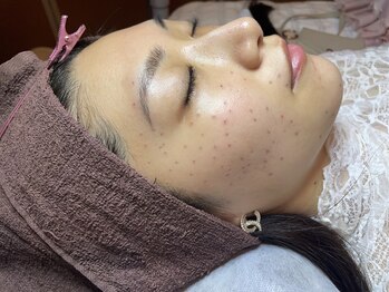 モテスリム/低周波シミケア