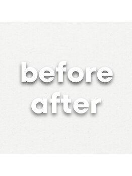 レミュー(Les mieux)/【お客様のBefore&Afterご紹介】