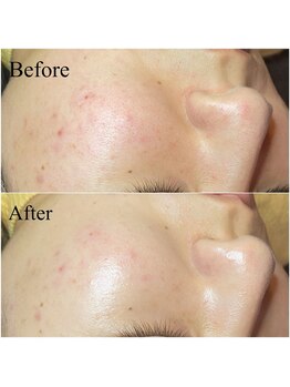 ブラックボックス(BLACK BOX)/水戸市20代女性のお客様