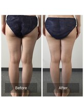 ボディメイクサロンアプローズ/