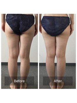 ボディメイクサロンアプローズ/