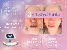 マシェリ(Ma che'rie)の雰囲気（《3ヶ月で変化を実感♪》透明感とハリUPをサポート◎）