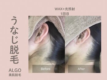 アルゴ 山口宇部店(ALGO)/その日に!うなじ脱毛+WAX