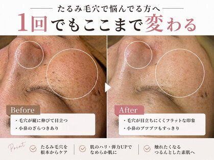 スコビ(SUKOBI)の写真