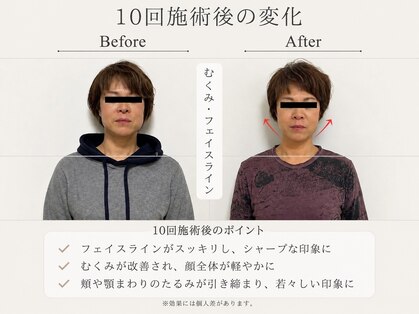 ハリスタ(HARISTA)の写真