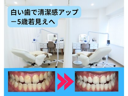ホワイトニングビューティー 行橋店の写真