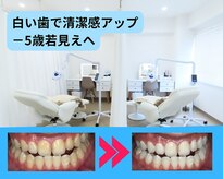 ホワイトニングビューティー 行橋店