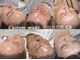 ディエール(Diailes)の写真