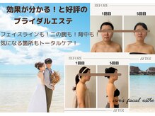 フェイシャルに特化した完全プライベートサロン★ブライダルOK★