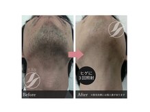 ビフォーアフター