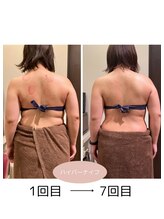 若松整体院 太白区院/ハイパーナイフ！