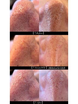 サロンドポノ(Salon de Pono)/韓国式3d毛穴洗浄