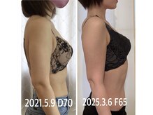 サチ(Sachi)の雰囲気（平均年齢４９歳★産後や年齢垂れ乳で悩む女性の駆け込みサロン）
