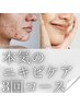 限定【ニキビケア】毛穴洗浄×選べるマシン徹底改善へ3回コース￥22,000
