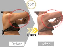 ジャパ(JAPA)/人気No.1ハイパーナイフ痩身