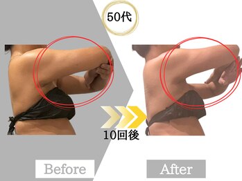 ジャパ(JAPA)/人気No.1ハイパーナイフ痩身