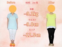 シュプリーム/洋服を買ったが着ることができず