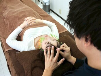 メモラ(memola)の写真/【脱！眼精疲労】目の疲れで世界が変わる◎ぱっちり目&小顔に《美容鍼/眼精疲労/小顔》