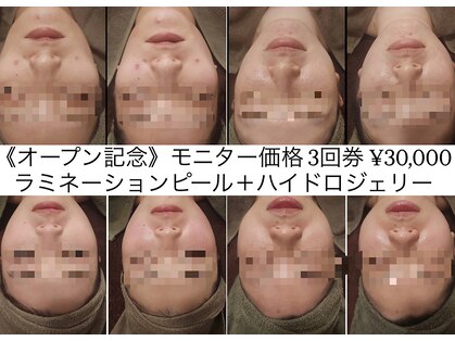 アルバ 高田馬場(alba)の写真