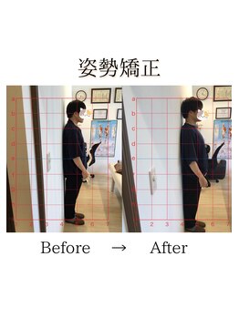 心斎橋長堀フェムテック整骨院/37姿勢矯正　骨格矯正と骨盤矯正