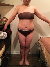 サロンドカイ(Salon de Kai)/痩身プログラム３カ月後