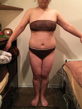 サロンドカイ(Salon de Kai)/痩身プログラム3カ月後